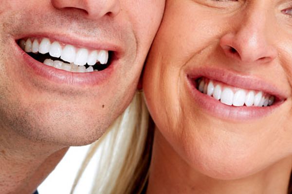 Here's What You Need to Know About Teeth Whitening -